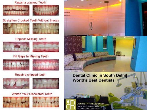 Dental Clinic in South Delhi- World’s Best Dentists are Available- Dentistry Redefined