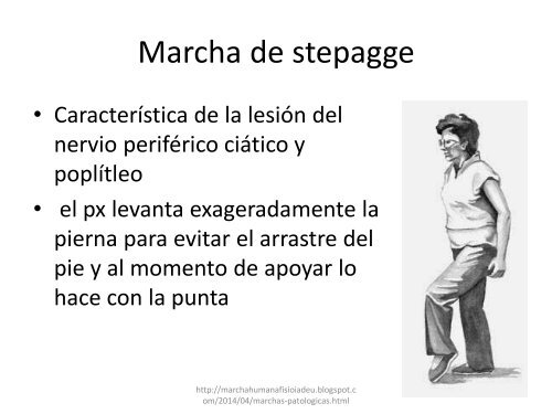 marchas patologicas