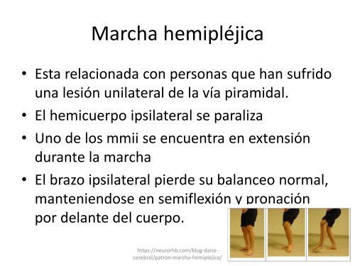 marchas patologicas