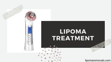 Lipoma Treatment _ Lipoma Removals