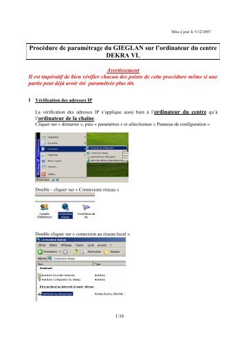 Procedure GIEGLAN VL