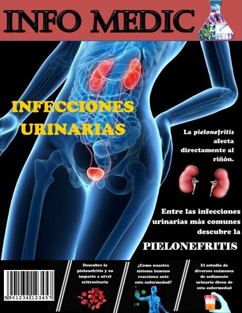 esas buenas chicas cistitis y prostatitis rai uno 3 esas buenas chicas cistitis y prostatitis rai uno 3