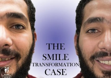 Smile Transformation case 