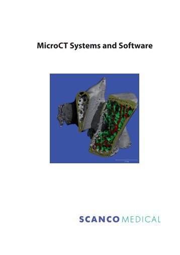 MicroCT Systems and Software