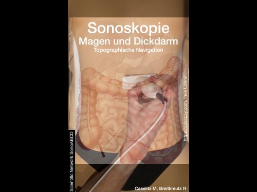 Sonoskopie Magen Darm nach Caselitz