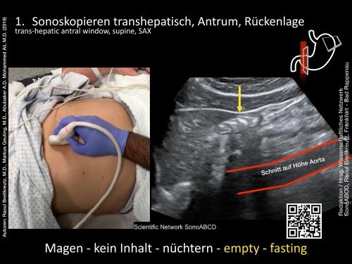 Magenultraschall - Gastric Content Exam