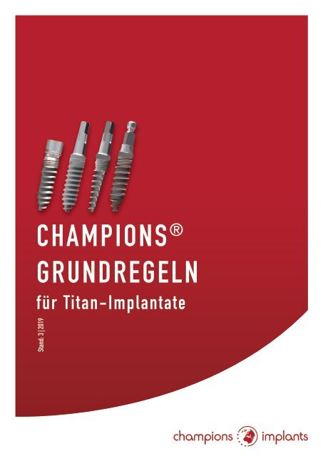 Titan-Implantate Grundregeln