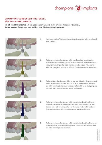 Champions Condenser-Protokolle für Titan- und BioWin! Implantate