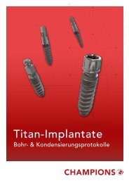 Bohr- und Kondensierungsprotokolle Titan-Implantate