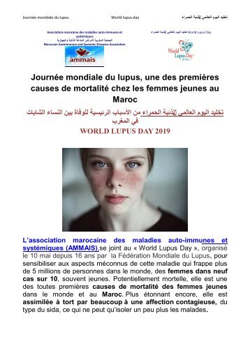 Journée mondiale du lupus , une des 1ères causes de la mortalité des femmes jeunes 