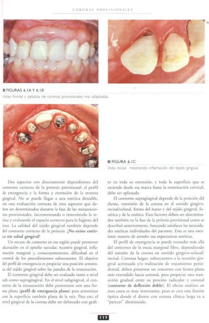 PROTESIS FIJA  LIBRO AUTOR PEGORARO