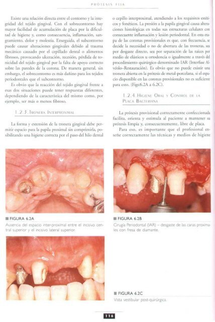 PROTESIS FIJA  LIBRO AUTOR PEGORARO