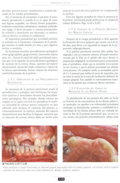 PROTESIS FIJA  LIBRO AUTOR PEGORARO