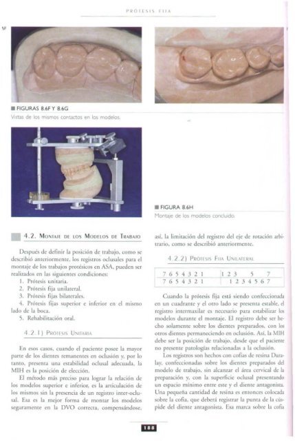 PROTESIS FIJA  LIBRO AUTOR PEGORARO