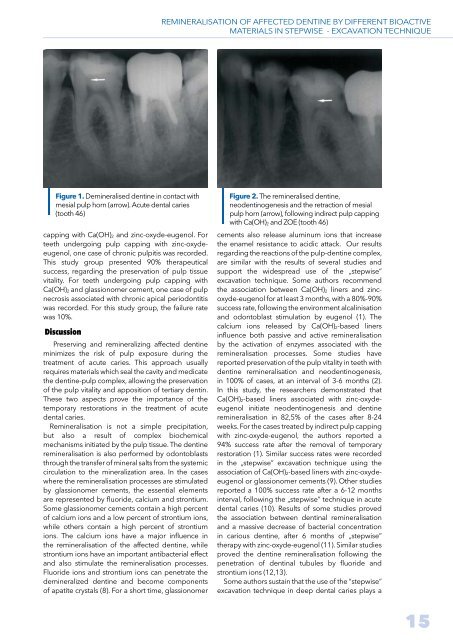 Stomatology Edu Journal 1/2014