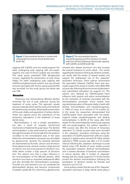 STOMATOLOGY EDU JOURNAL 1-2014