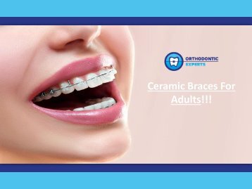 How Much Are Ceramic Braces | Orthodontic Experts of Colorado