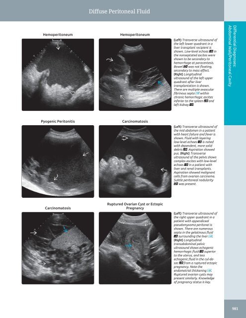 Diagnostic Ultrasound - Abdomen and Pelvis