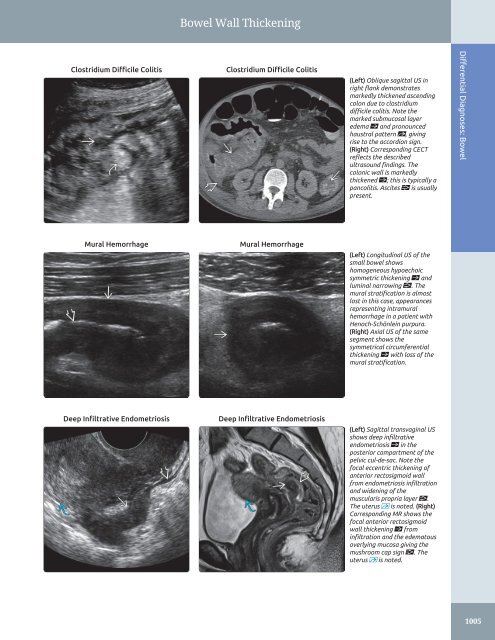 Diagnostic Ultrasound - Abdomen and Pelvis