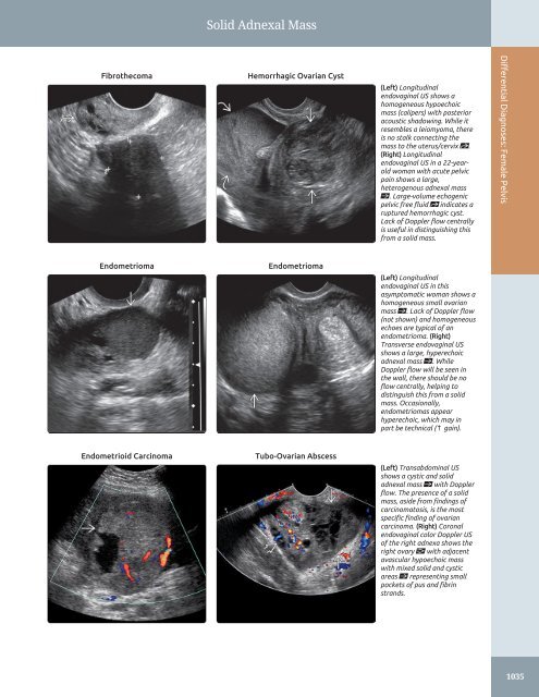 Diagnostic Ultrasound - Abdomen and Pelvis