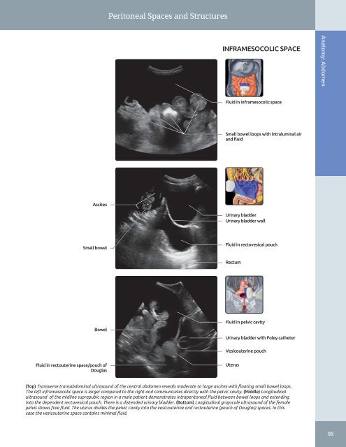 Diagnostic Ultrasound - Abdomen and Pelvis