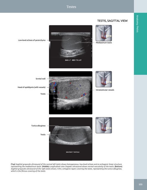 Diagnostic Ultrasound - Abdomen and Pelvis