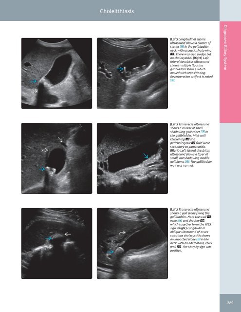 Diagnostic Ultrasound - Abdomen and Pelvis