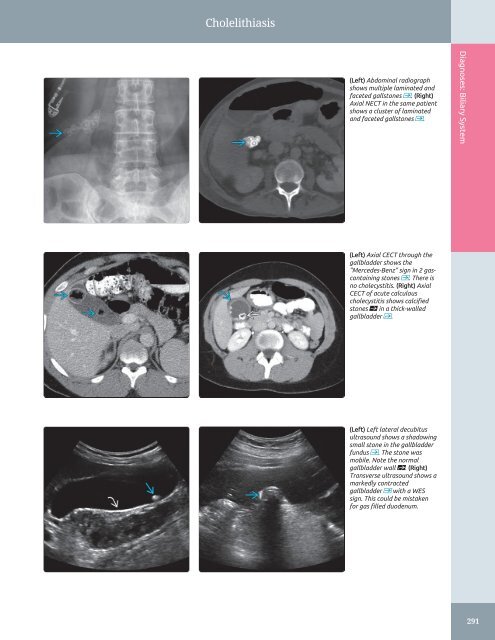 Diagnostic Ultrasound - Abdomen and Pelvis