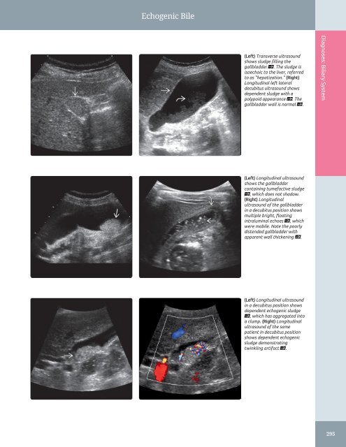 Diagnostic Ultrasound - Abdomen and Pelvis