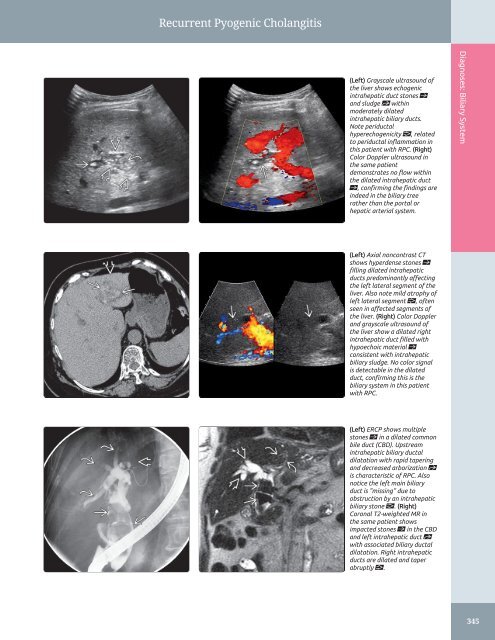 Diagnostic Ultrasound - Abdomen and Pelvis