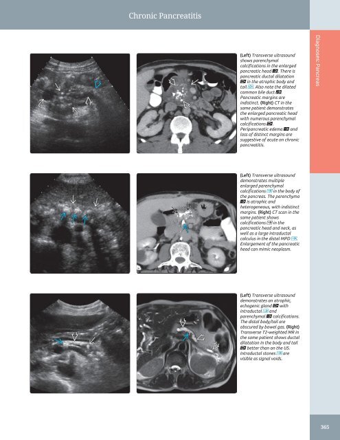 Diagnostic Ultrasound - Abdomen and Pelvis