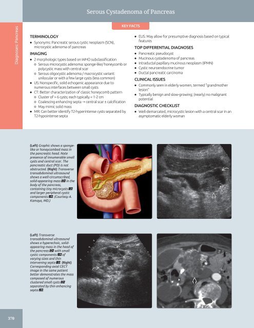 Diagnostic Ultrasound - Abdomen and Pelvis