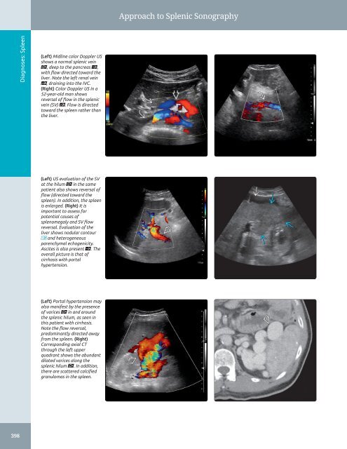 Diagnostic Ultrasound - Abdomen and Pelvis