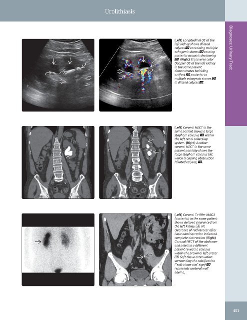 Diagnostic Ultrasound - Abdomen and Pelvis