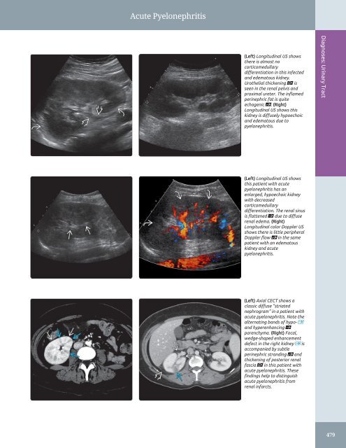 Diagnostic Ultrasound - Abdomen and Pelvis