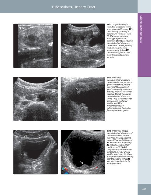 Diagnostic Ultrasound - Abdomen and Pelvis