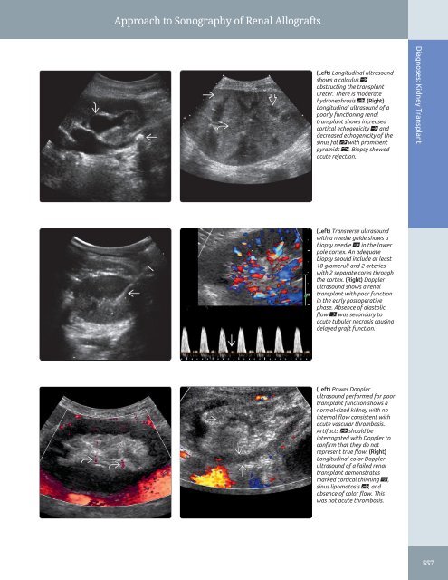 Diagnostic Ultrasound - Abdomen and Pelvis