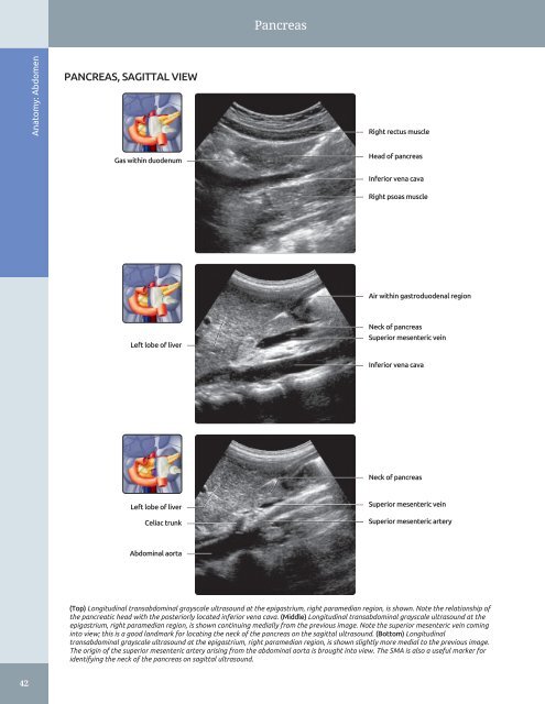 Diagnostic Ultrasound - Abdomen and Pelvis