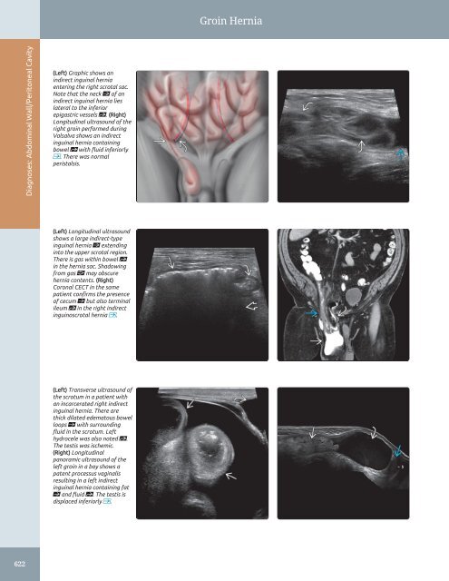 Diagnostic Ultrasound - Abdomen and Pelvis