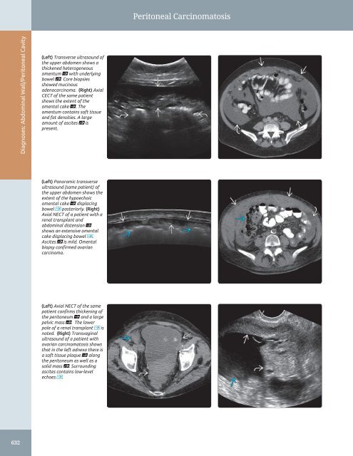 Diagnostic Ultrasound - Abdomen and Pelvis