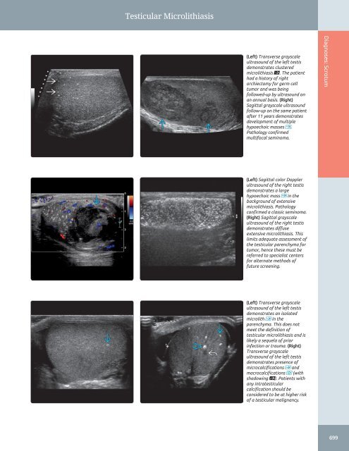 Diagnostic Ultrasound - Abdomen and Pelvis