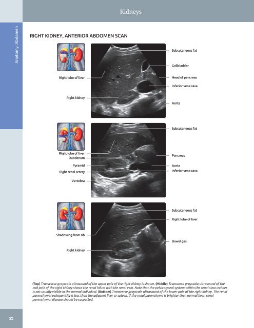 Diagnostic Ultrasound - Abdomen and Pelvis