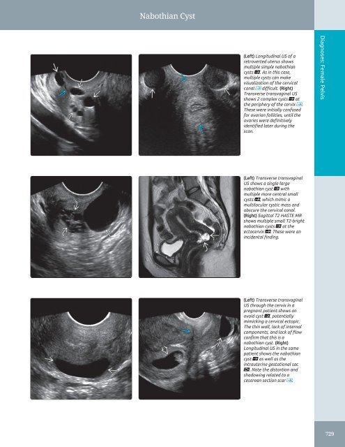 Diagnostic Ultrasound - Abdomen and Pelvis