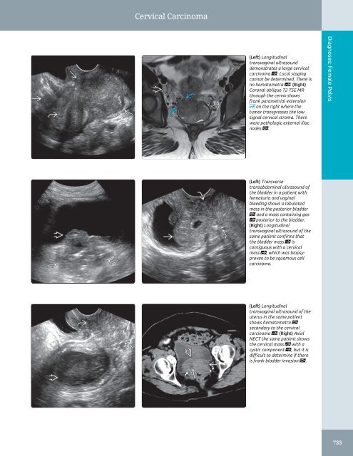 Diagnostic Ultrasound - Abdomen and Pelvis