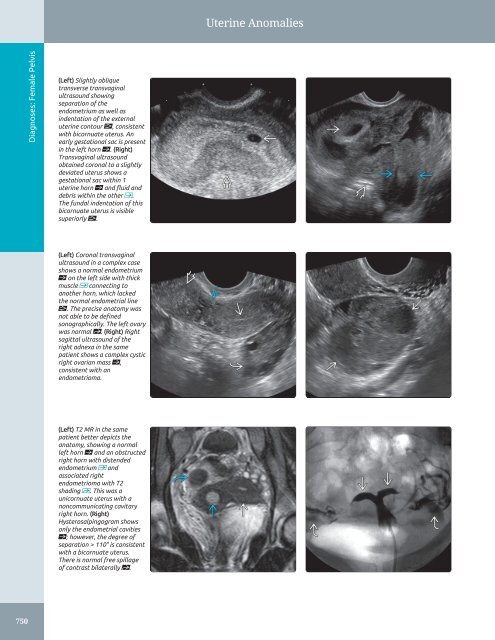 Diagnostic Ultrasound - Abdomen and Pelvis