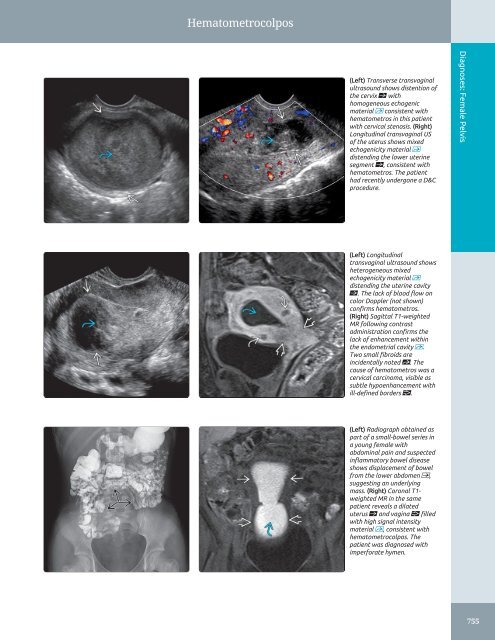 Diagnostic Ultrasound - Abdomen and Pelvis