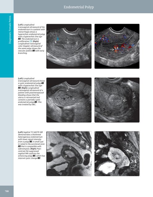 Diagnostic Ultrasound - Abdomen and Pelvis