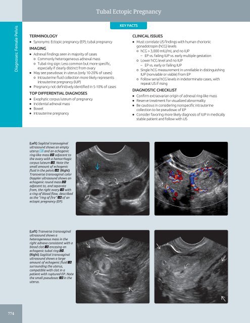 Diagnostic Ultrasound - Abdomen and Pelvis