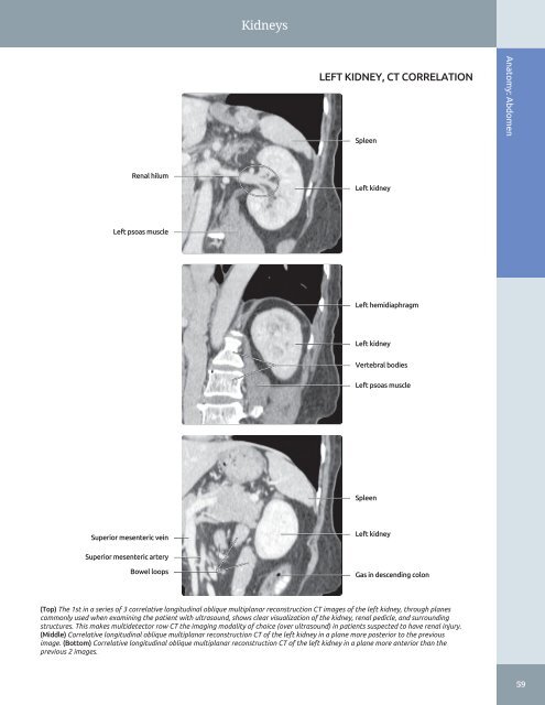 Diagnostic Ultrasound - Abdomen and Pelvis