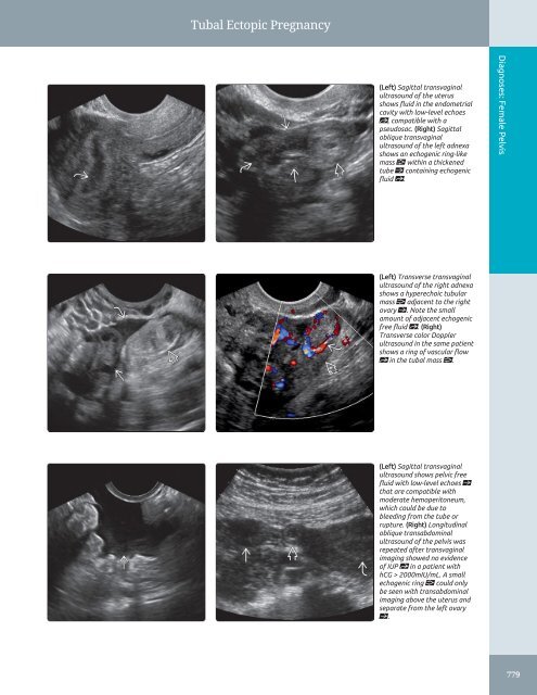 Diagnostic Ultrasound - Abdomen and Pelvis